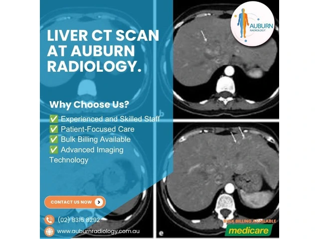 Liver CT Scan at Auburn Radiology. (02) 8315 8292 photo 1