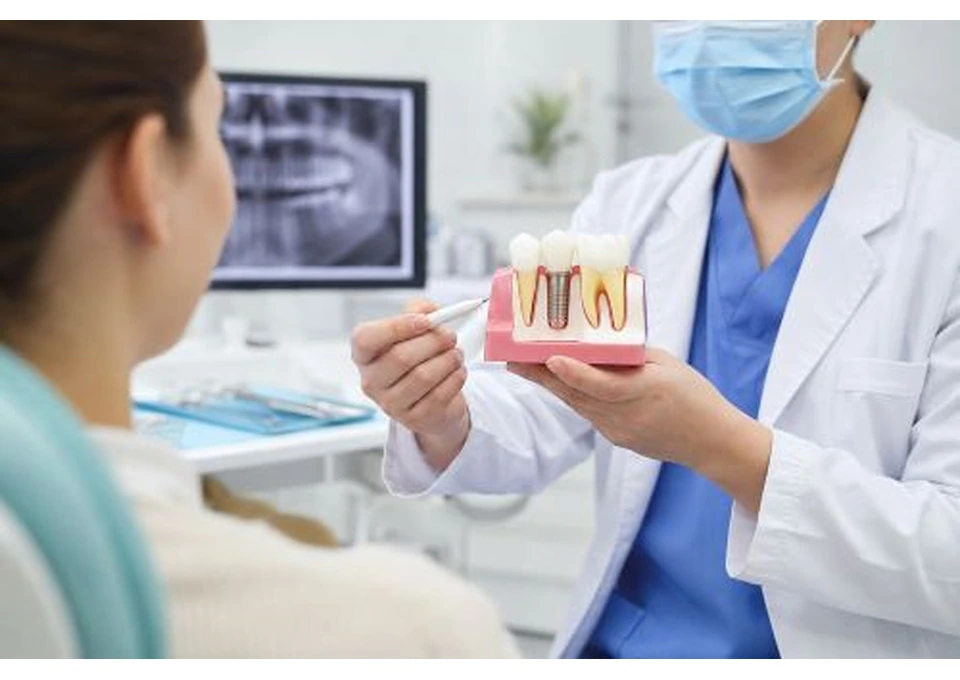 Dental Implants in Baulkham Hills: What Patients Should Know Before Treatment photo 1