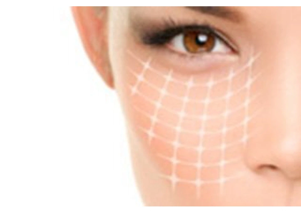 Ultraformer Melbourne | Hifu Balwyn | Advanced Beautytech Laser Clinic photo 1