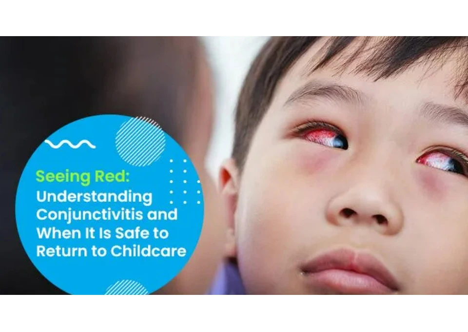 Keeping Children Safe from Conjunctivitis at Childcare in Nollamara photo 1