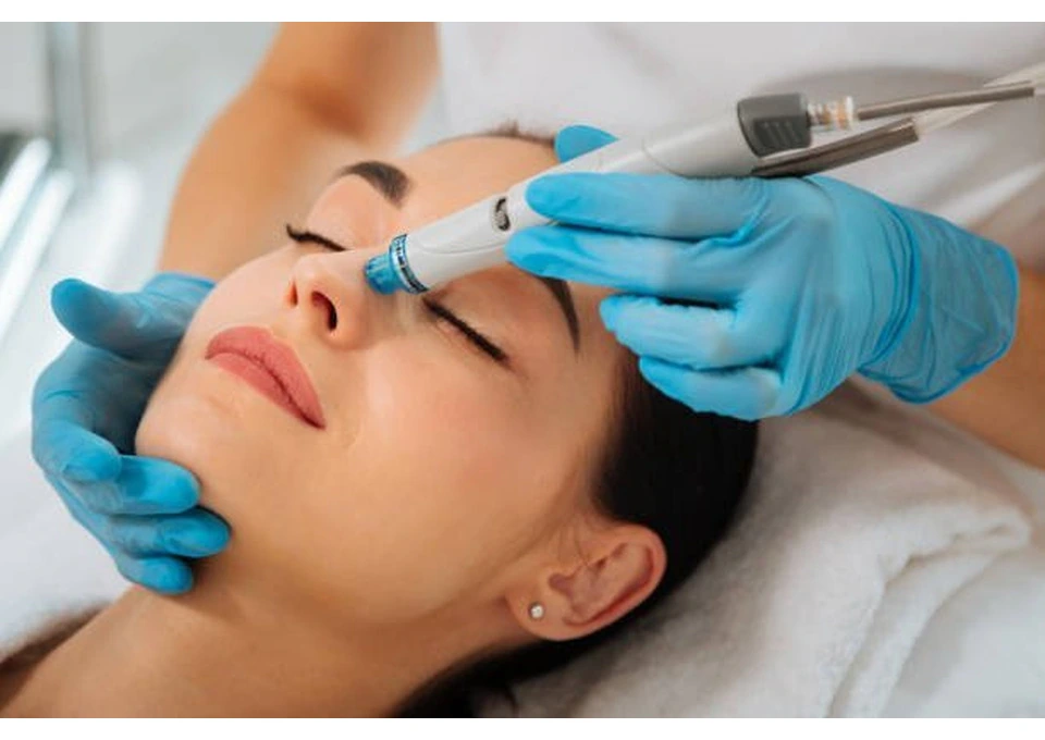 Get Smoother, Brighter Skin With A Professional Peel Today photo 1