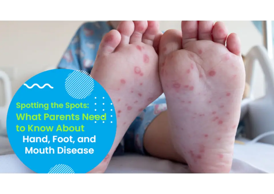 Learn About HFMD Prevention and Care at Dayton Daycare Centre photo 1