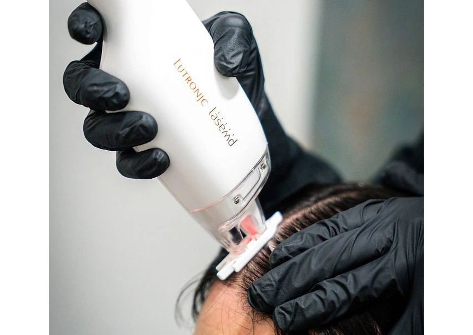 Discover Hair Restoration Options with a Hair Loss Specialist in Sydney