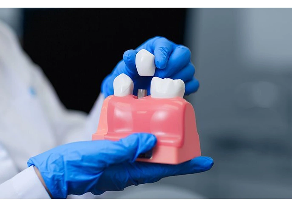 Why Early Gum Disease Treatment Is Essential for Healthy Gums