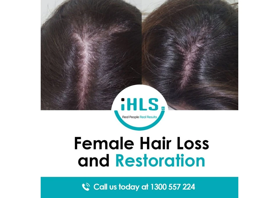 Professional Hair Restoration Services for Women in Perth photo 1