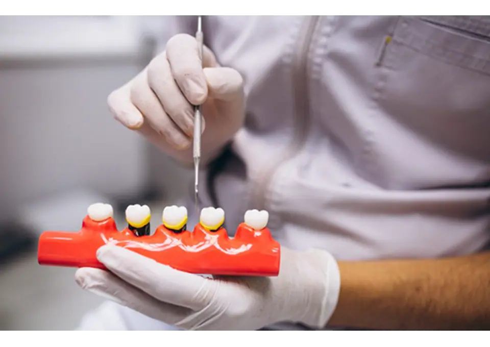 Find Trusted Dental Crowns Services in Greensborough Today photo 1