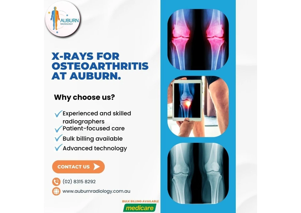 X-rays for Osteoarthritis at Auburn Radiology. (02) 8315 8292 photo 1